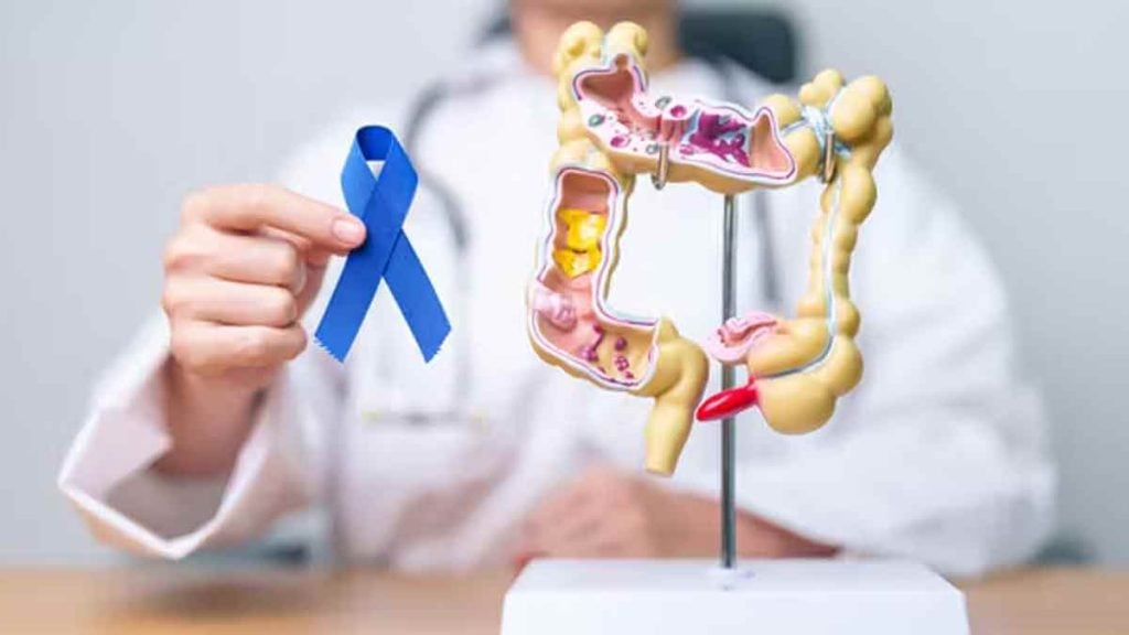 « Je pensais être protégé »  Sportif, végétarien et non-fumeur, Balram a pourtant développé un cancer colorectal